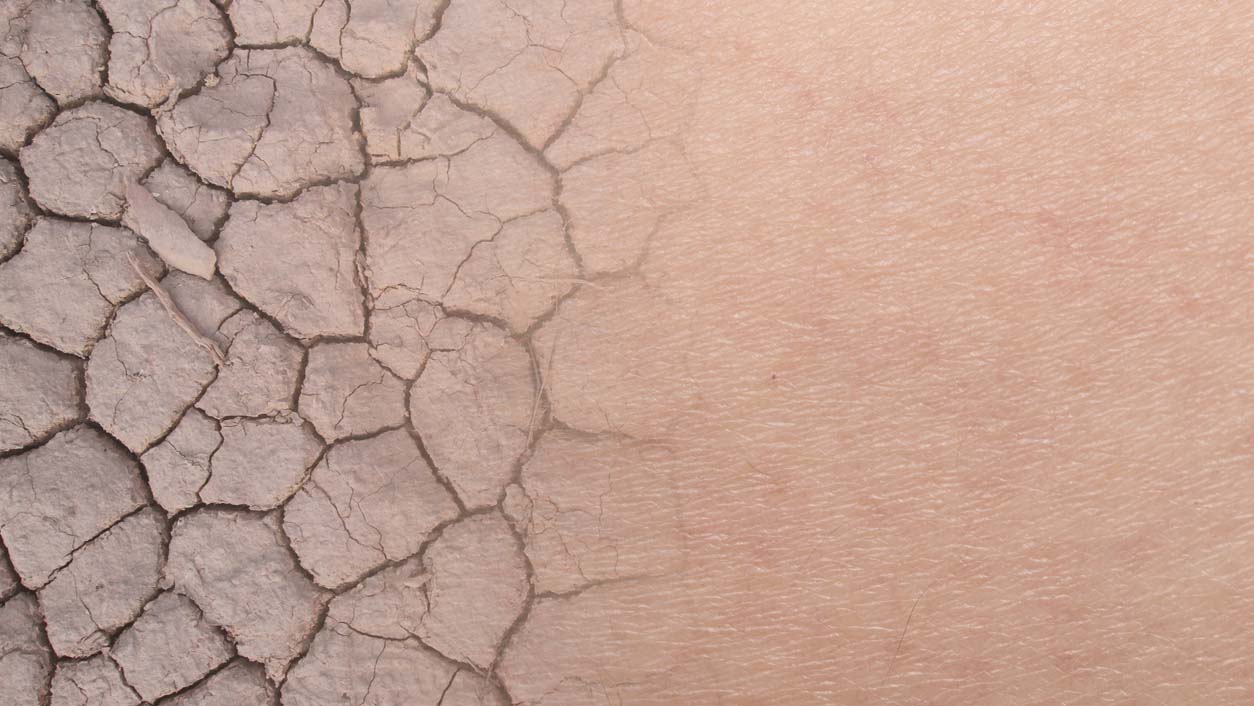 Ultimate Guide: How to Take Care of Dry and Dehydrated Skin