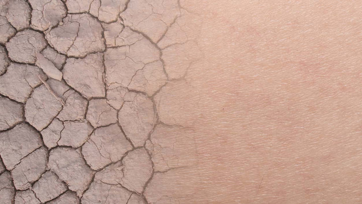 Ultimate Guide: How to Take Care of Dry and Dehydrated Skin